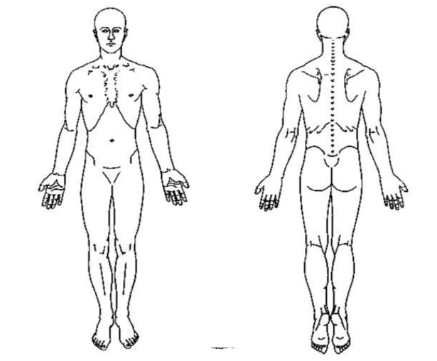 Body Diagram